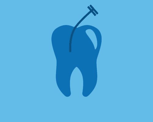 Endodonzia