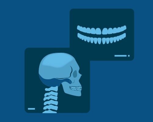 Radiologia Digitale