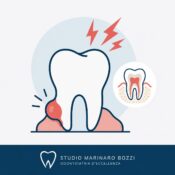 ascesso cosa fare studio marinaro bozzi bari